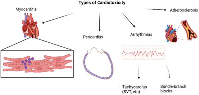 Cardiotoxicity induced by immune checkpoint inhibitor: The complete insight into mechanisms, monitoring, diagnosis, and treatment